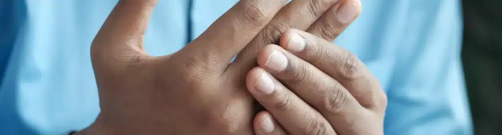 arthritic hands